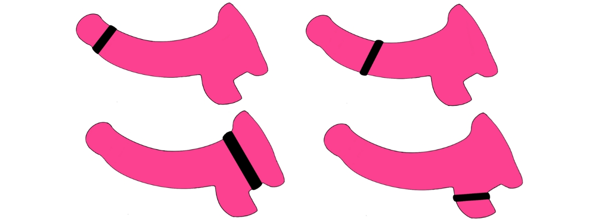 informatieve-illustratie-cockringen